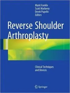 Reverse Shoulder Arthroplasty: Biomechanics, Clinical Techniques, and Current Technologies (repost)