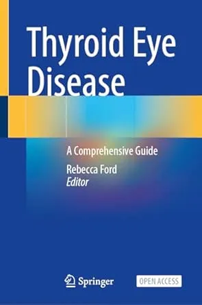 Thyroid Eye Disease: A Comprehensive Guide