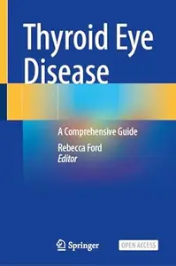Thyroid Eye Disease: A Comprehensive Guide
