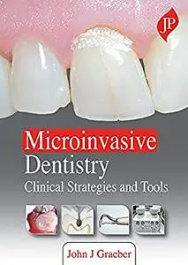 Microinvasive Dentistry: Clinical Strategies and Tools