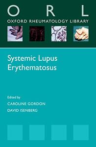 Systemic Lupus Erythematosus (Repost)