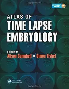 Atlas of Time Lapse Embryology