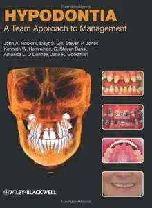 Hypodontia: A Team Approach to Management (repost)