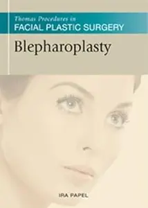 Blepharoplasty