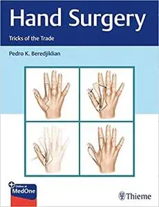 Hand Surgery: Tricks of the Trade