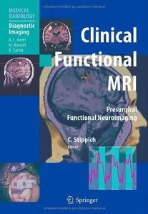 Clinical Functional MRI: Presurgical Functional Neuroimaging (Repost)