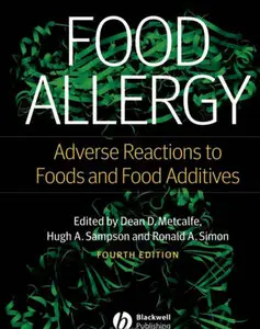 Food Allergy, 4 edition (Repost)