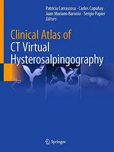 Clinical Atlas of CT Virtual Hysterosalpingography (Repost)