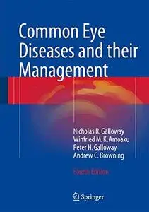 Common Eye Diseases and their Management [Repost]