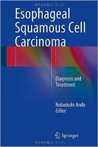 Esophageal Squamous Cell Carcinoma: Diagnosis and Treatment