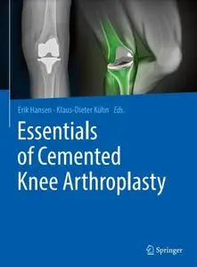 Essentials of Cemented Knee Arthroplasty (Repost)