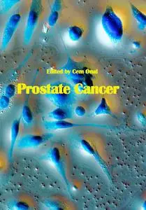 "Prostate Cancer" ed. by Cem Onal
