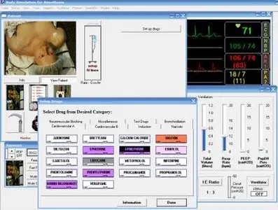 Body Simulation for Anesthesia