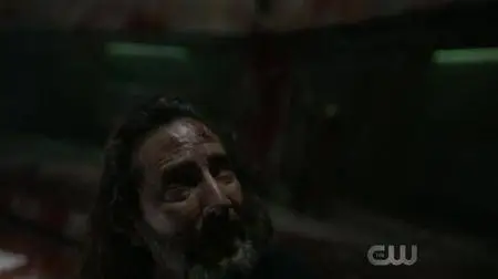 The 100 S05E04