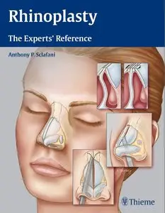 Rhinoplasty: The Experts' Reference