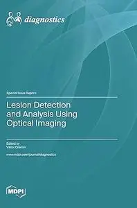 Lesion Detection and Analysis Using Optical Imaging