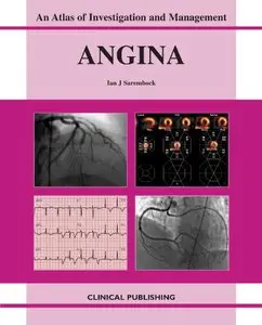 Angina: An Atlas of Investigation and Management by I. J. Sarembock