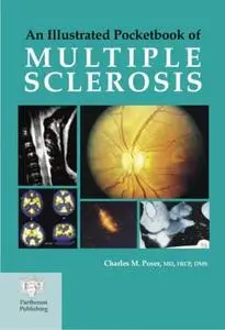 An Illustrated Pocketbook of Multiple Sclerosis (Repost)