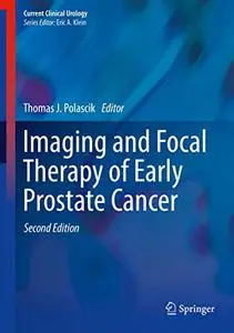 Imaging and Focal Therapy of Early Prostate Cancer (Repost)