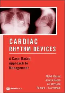 Cardiac Rhythm Devices: A Case-Based Approach to Management