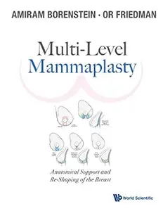 Multi-level Mammaplasty