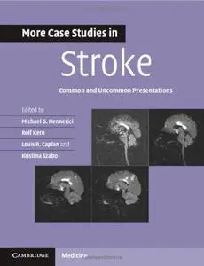 More Case Studies in Stroke: Common and Uncommon Presentations