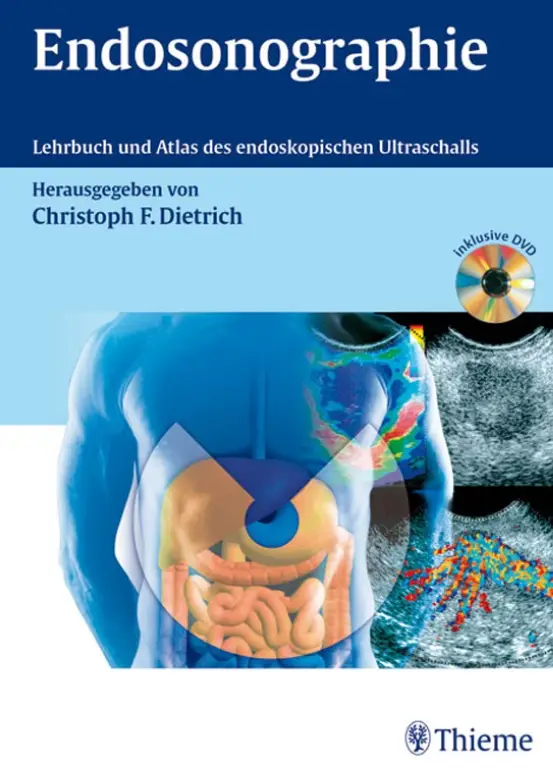 Endosonographie: Lehrbuch und Atlas des endoskopischen Ultraschalls