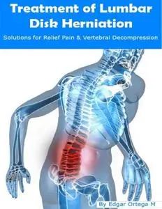 «Treatment of Lumbar Disk Herniation» by Edgar Ortega M.