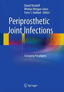 Periprosthetic Joint Infections: Changing Paradigms(Repost)