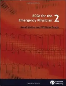 ECGs for the Emergency Physician: Level 2