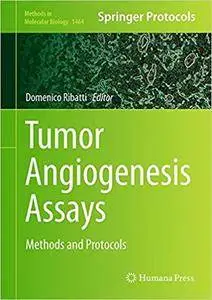 Tumor Angiogenesis Assays: Methods and Protocols (Repost)