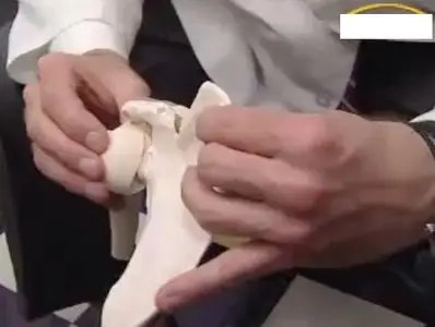 Video of "The Athlete's Shoulder - Leading Edge Surgical Repair " 2009