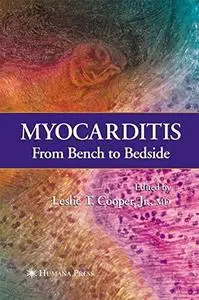 Myocarditis: From Bench to Bedside