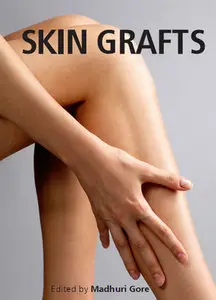 "Skin Grafts" ed. by Madhuri Gore