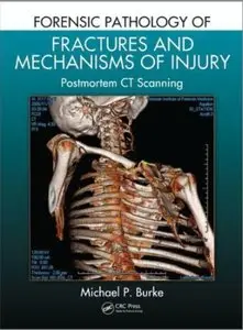 Forensic Pathology of Fractures and Mechanisms of Injury: Postmortem CT Scanning [Repost]