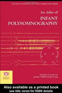 An Atlas of Infant Polysomnography (Encyclopedia of Visual Medicine Series) by David H. Crowell