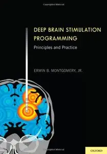 Deep Brain Stimulation Programming: Principles and Practice