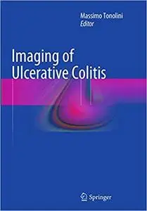 Imaging of Ulcerative Colitis (Repost)