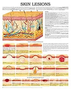 Skin lesions e chart: Full illustrated