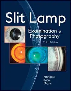 Slit Lamp: Examination and Photography