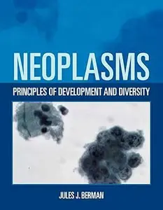 Neoplasms: Principles of Development and Diversity: Principles of Development and Diversity