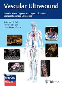 Vascular Ultrasound