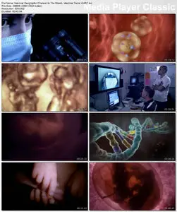 National Geographic - In The Womb Identical Twins (2008)