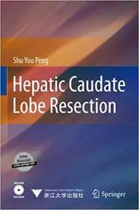 Hepatic Caudate Lobe Resection