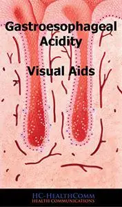 Gastroesophageal Acidity Visual Aids: Full Illustrated