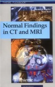 Normal Findings in CT and MRI [Repost]