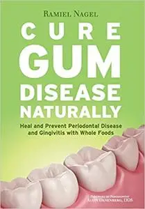 Cure Gum Disease Naturally: Heal and Prevent Periodontal Disease and Gingivitis with Whole Foods (repost)