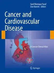 Cancer and Cardiovascular Disease: A Concise Clinical Atlas (Repost)