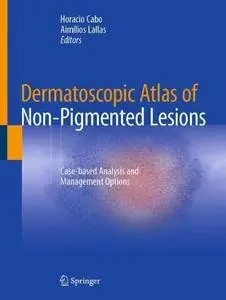 Dermatoscopic Atlas of Non-Pigmented Lesions: Case-based Analysis and Management Options