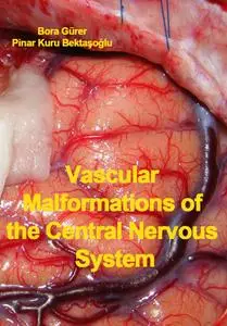 "Vascular Malformations of the Central Nervous System" ed. by Bora Gürer, Pinar Kuru Bektaşoğlu